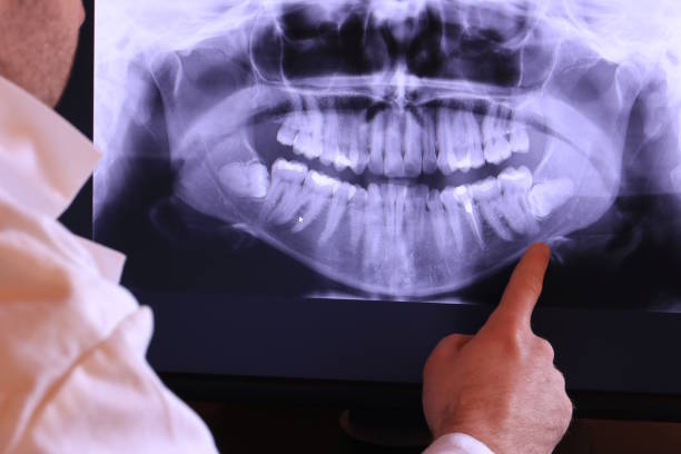 Best Chipped Tooth Repair Near Me  in Sullivan Gardens, TN
